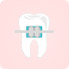 歯の矯正